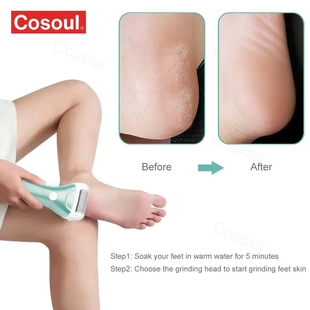 Elektrische Fuß feile Pediküre Werkzeuge Füße Kallus entferner wiederauf ladbare Fuß wäscher Füße Pflege für tote, hart rissige trockene Haut