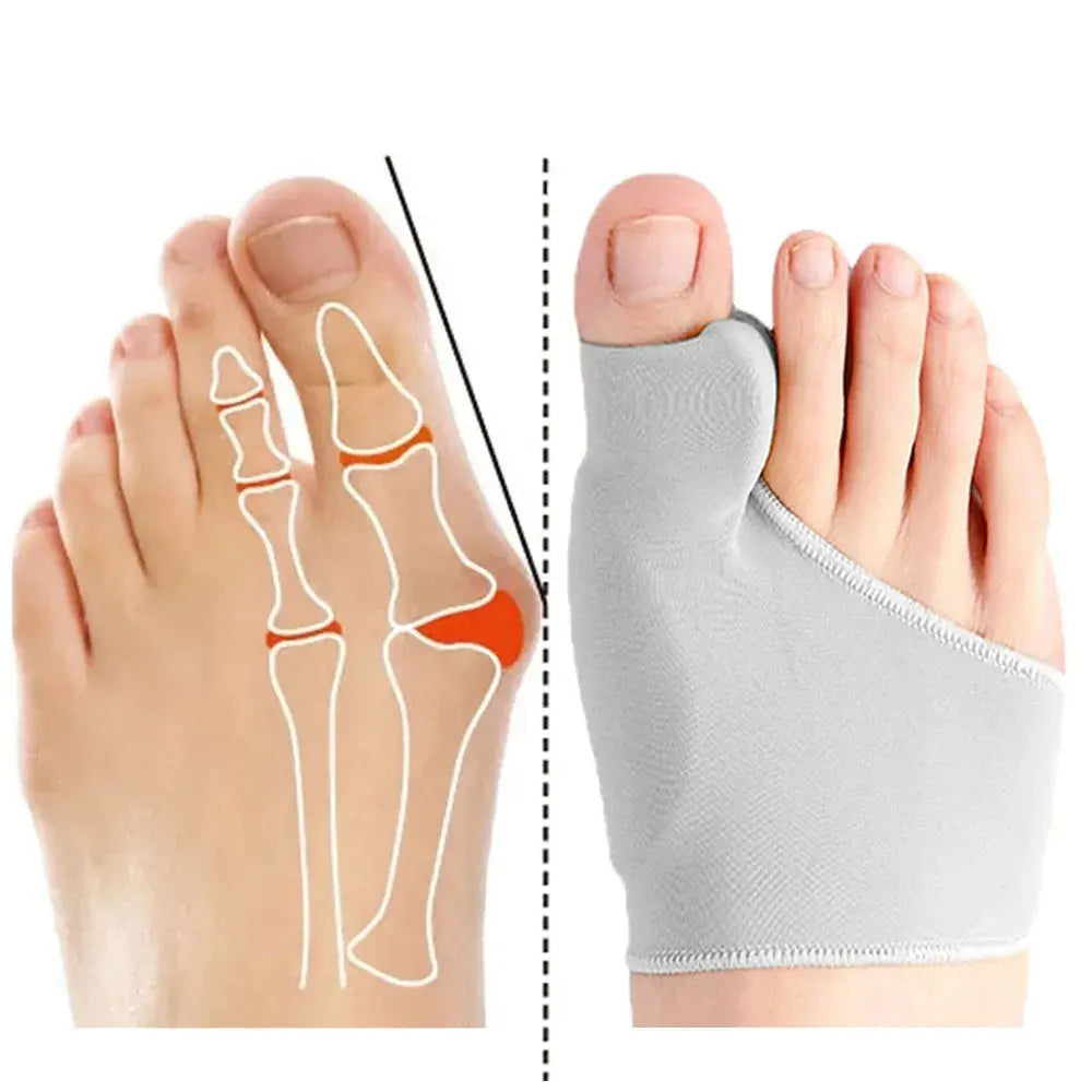 Toe Separator Hallux Valgus Bunion Corrector Orthesen Fuß Knochen Daumen Teller Korrektur Pediküre Socke Haarglätter